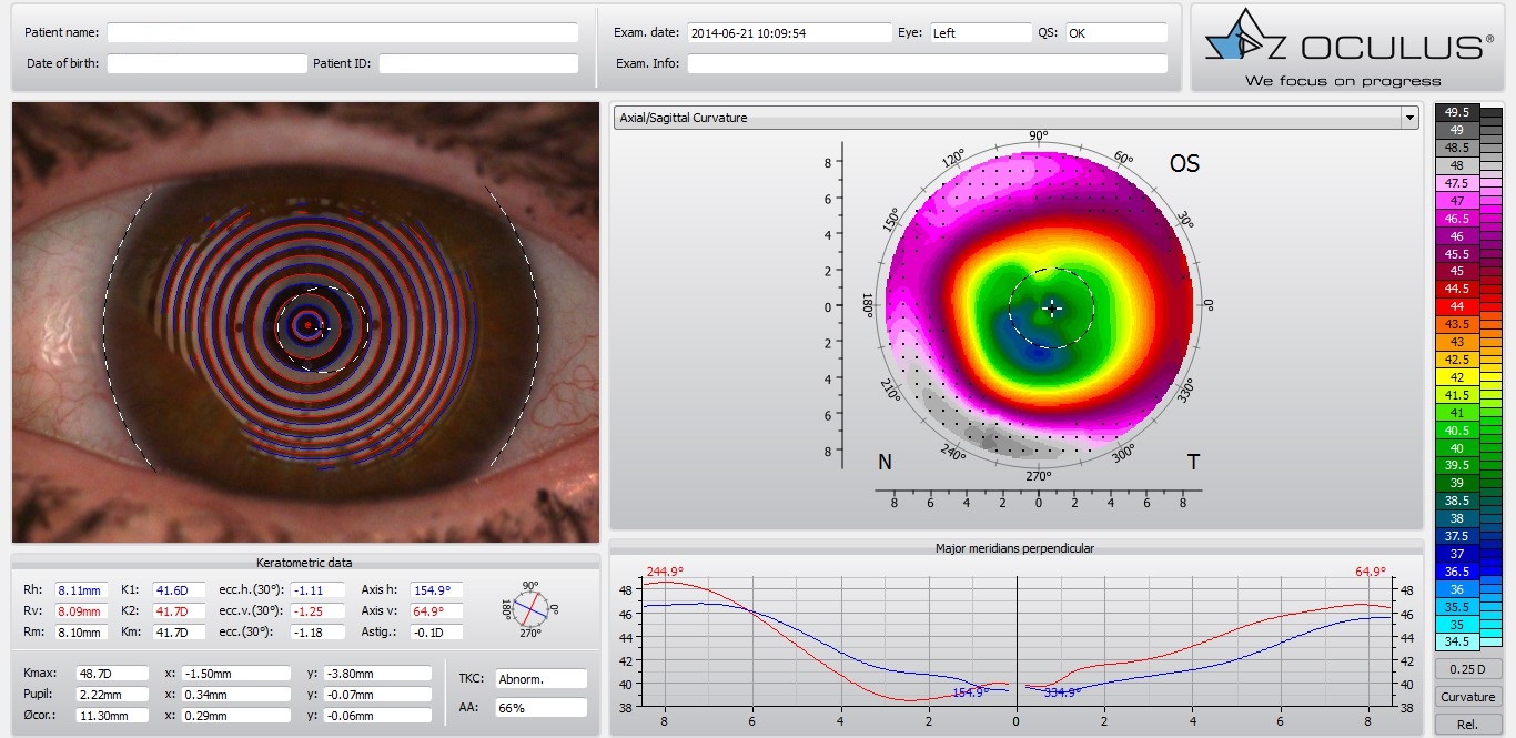 Topographe Optika